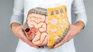 Signs and Conditions That May Require an Intestine Transplant