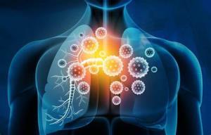 How to Maintain a Healthy Immune System After a Lung Transplant