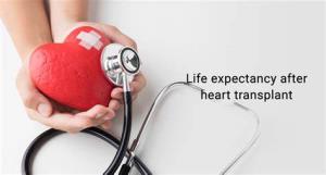 The Impact of Heart Transplant on Life Expectancy