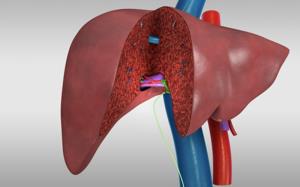 How Bile Duct Issues Are Managed After Liver Transplant Surgery