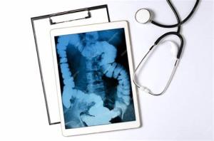 The Role of Telemedicine in Intestine Transplant Follow-Up Care