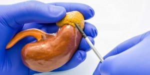 Exploring the Link Between Obesity and Kidney Transplant Success Rates