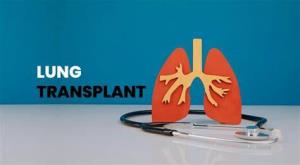 The Role of Advanced Imaging in Lung Transplant Evaluation