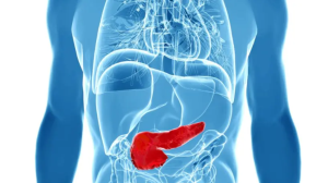 Essential Stages of Post-Surgery Recovery for Pancreas Transplant Patients