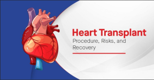 Heart Transplant in India