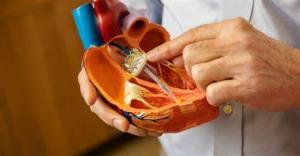 How TAVR Procedure Reduces the Need for Open-Heart Surgery