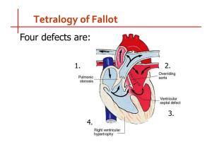 Advances in Cardiac Imaging for Tetralogy of Fallot Diagnosis