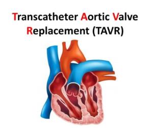 Causes and Symptoms Indicating the Need for TAVR Surgery