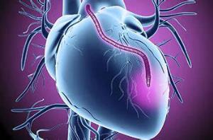 Understanding the Risks Involved in Heart Bypass Surgery