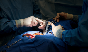 The Latest Innovations in VSD Surgery Advancements in Treatment