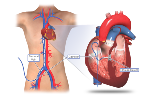 Best VSD Surgery Hospitals in India