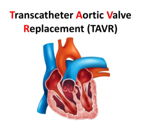 Best TAVR Procedure Hospitals in India