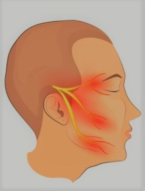 Legal and Ethical Considerations for Trigeminal Neuralgia Surgery in India