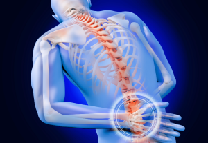 Symptoms That Indicate You May Need Spinal Fusion Surgery