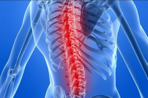 Common Causes Leading to Spinal Fusion Surgery: When Is It Necessary?