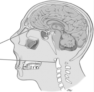 Understanding Diagnostic Approaches for Skull Base Conditions