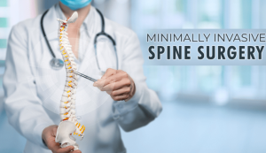 Exploring Advances in Minimally Invasive Spinal Cord Surgery