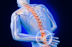 Spinal Fusion Surgery in India