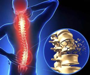 Spinal Cord Surgery in India