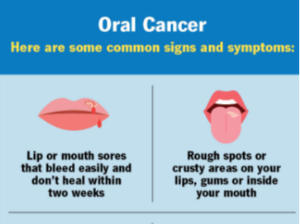 Understanding Oral or Mouth Cancer: Cause, Symptoms, Diagnosis and Prevention