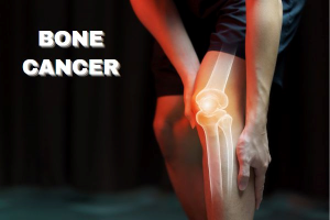 what is Bone Cancer