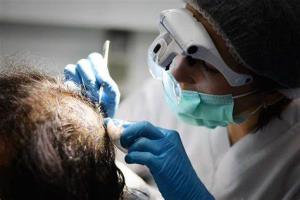 Latest Advancements in Hair Restoration Technology