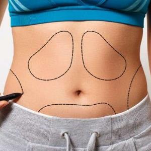 Non Surgical Options for Tummy Tuck Surgery