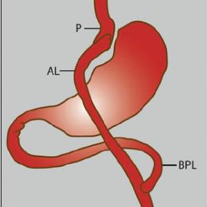 How RYGB Surgery Can Lead to Increased Energy Levels