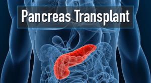 Pancreas Transplant in India