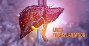 Liver Transplant in India