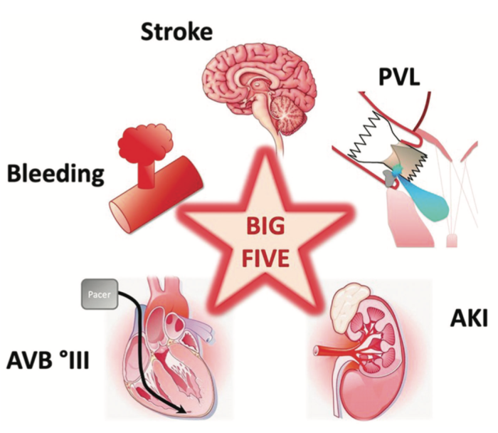 Common Risks and Complications Linked to TAVR Surgery