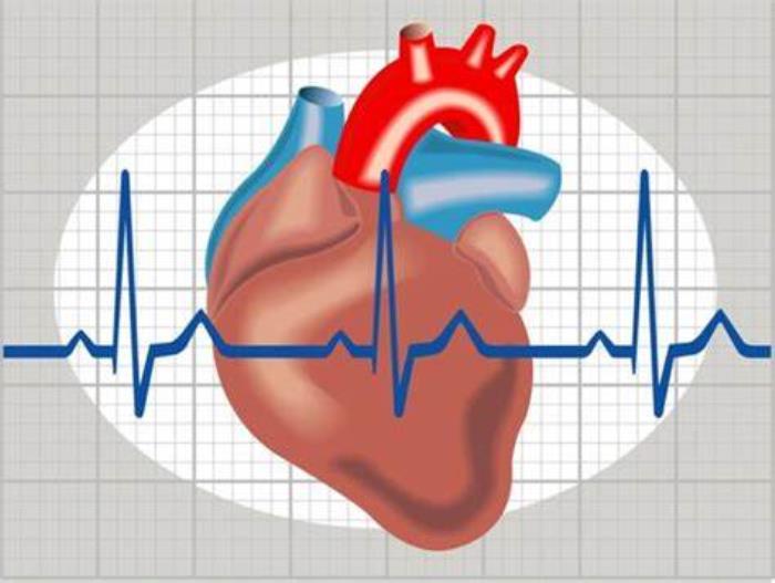 Cardiac Arrhythmias After TOF Repair