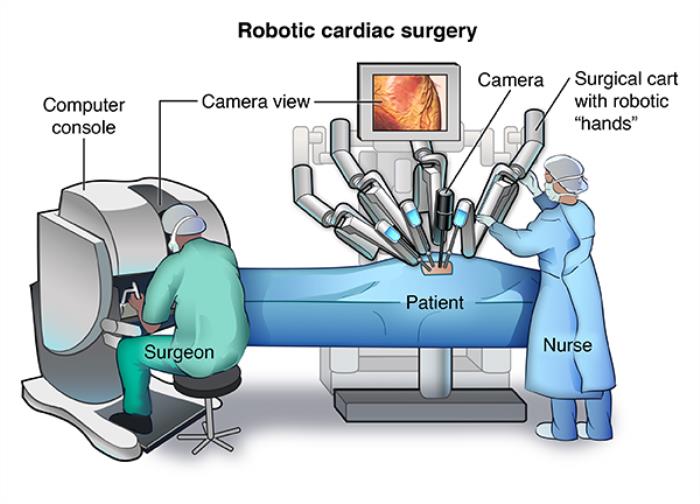 The Precision Advantage of Robotic-Assisted Heart Surgery