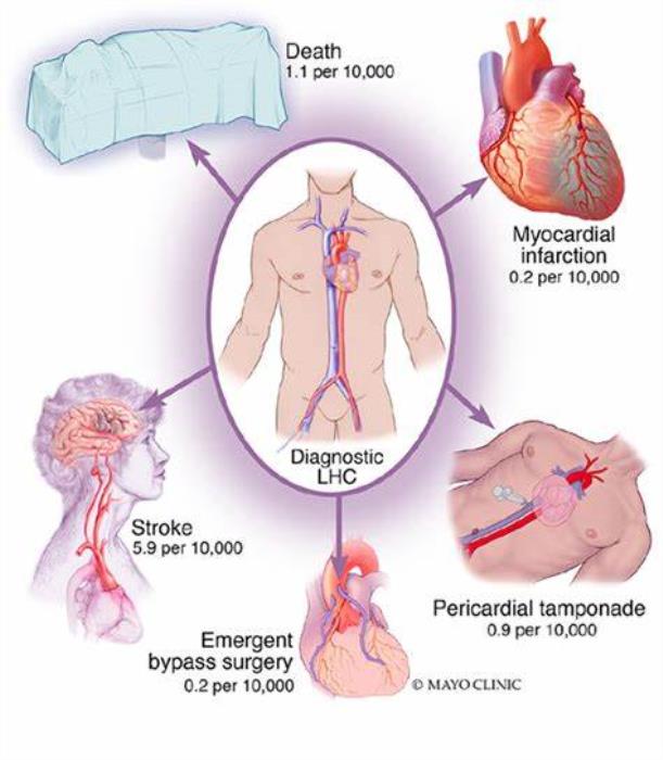 Overview of Common Risks and Complications