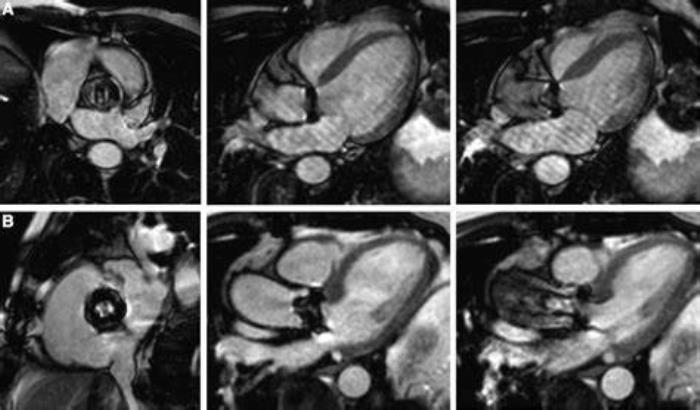 Traditional Imaging Techniques for Heart Valve Assessment