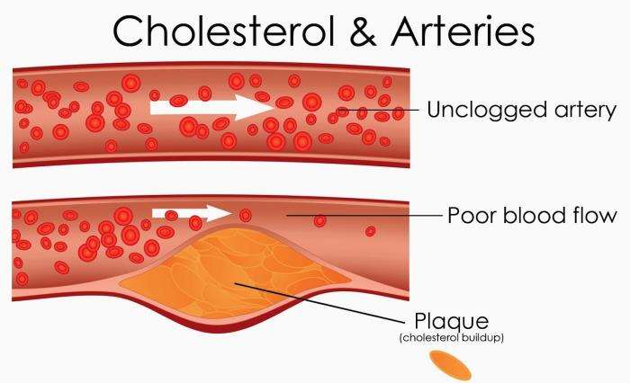 The Benefits of Regular Cholesterol Screenings