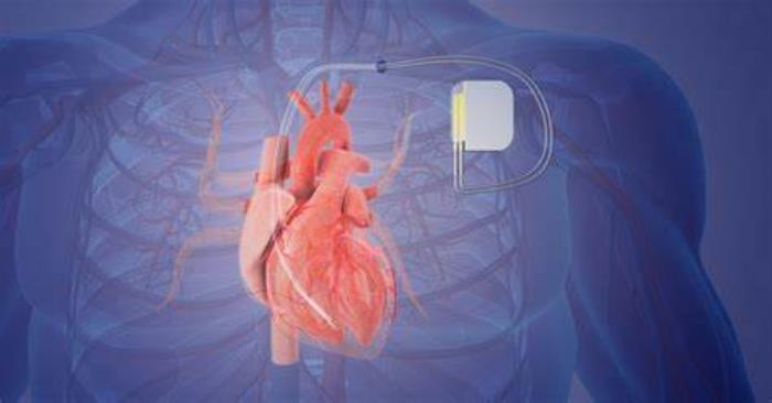 How Technological Advancements Improve Pacemaker Maintenance