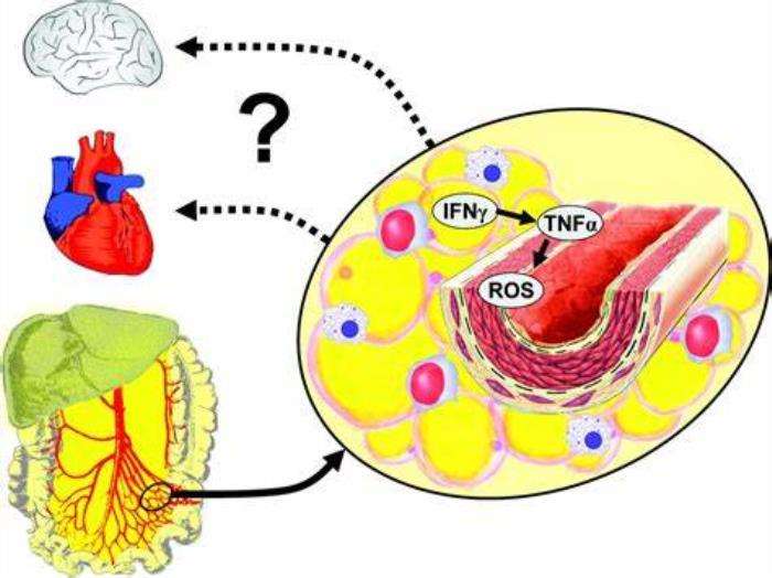 How Obesity Contributes to Vascular Inflammation