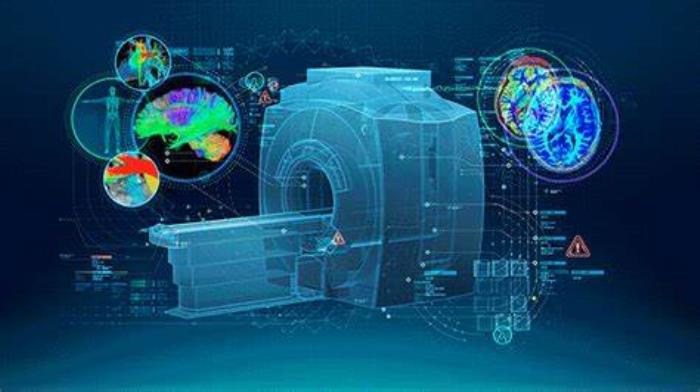 Use of 3D Imaging and Virtual Planning in Mitral Valve Surgery