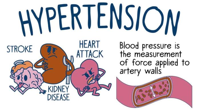 Hypertension: Long-term Effects on Blood Pressure