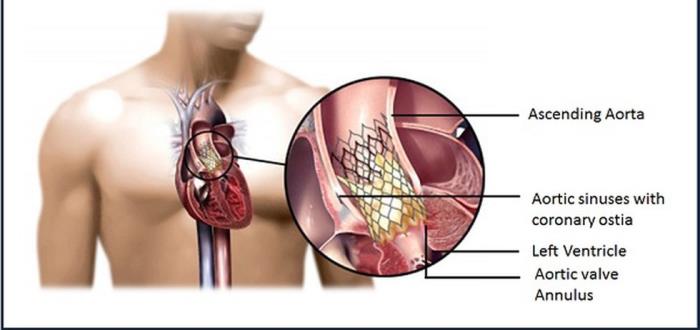 The Impact of Medications on Post-Surgery Recovery Time