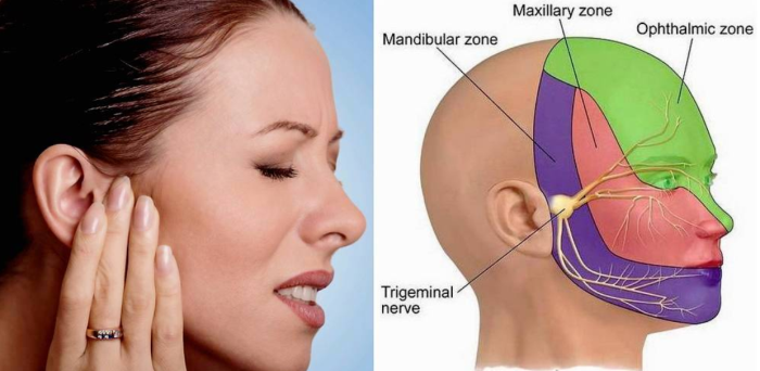 Best Trigeminal Neuralgia Surgery in India