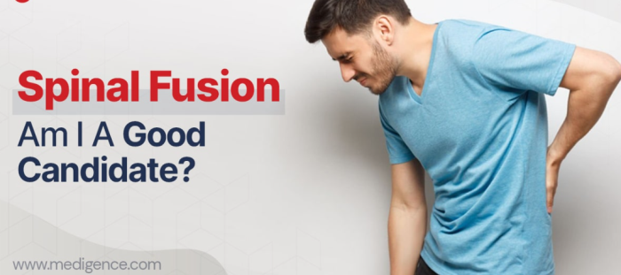 Top Symptoms That Indicate You May Need Spinal Fusion Surgery