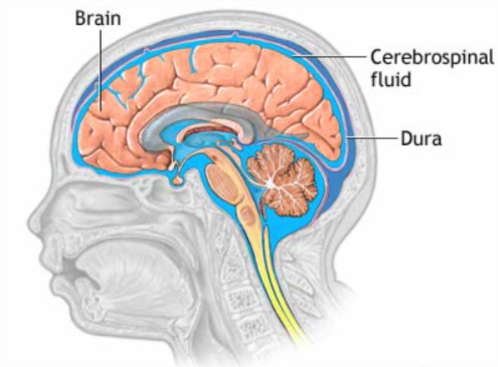 Symptoms of Cerebrospinal Fluid (CSF) Leaks