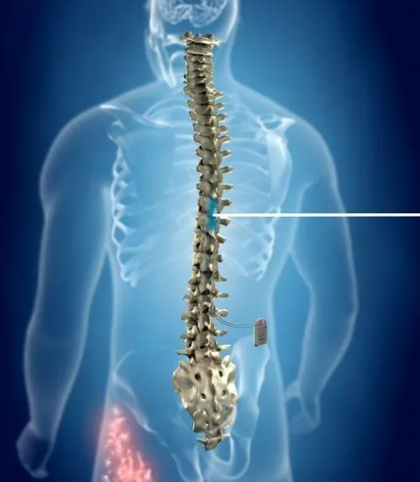 The Role of the Spinal Cord in Pain Perception