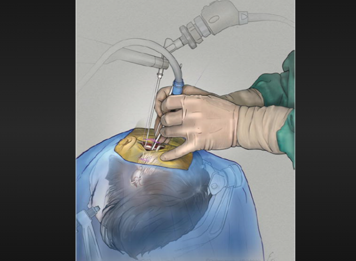  Surgical Procedure: Step-by-Step Guide