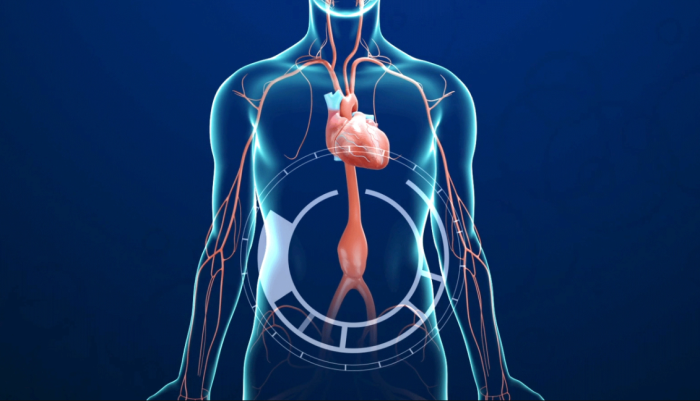 The Importance of Graft Selection in Aneurysm Treatment