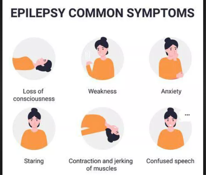 Common Symptoms of Epilepsy