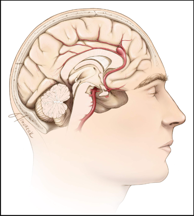 The Anatomy of the Brain and Aneurysm Formation