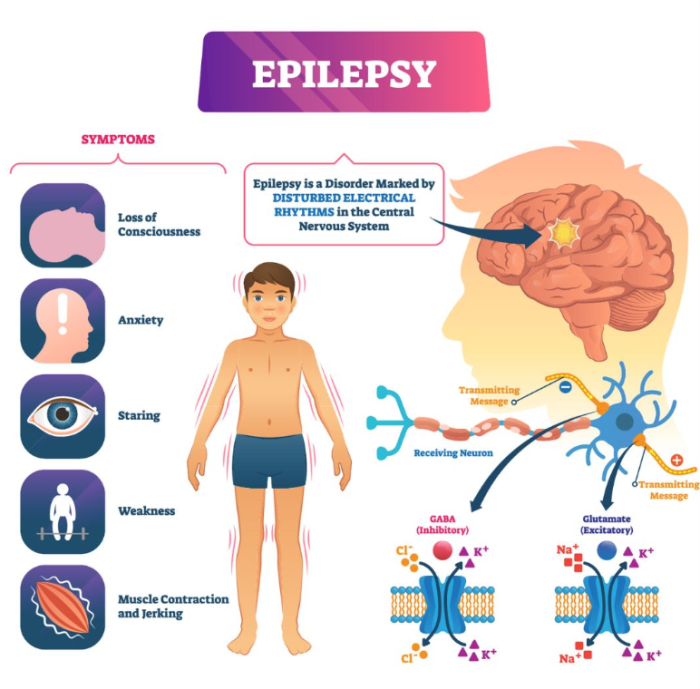 Epilepsy and DBS: Unique Risks for Seizure Control Patients